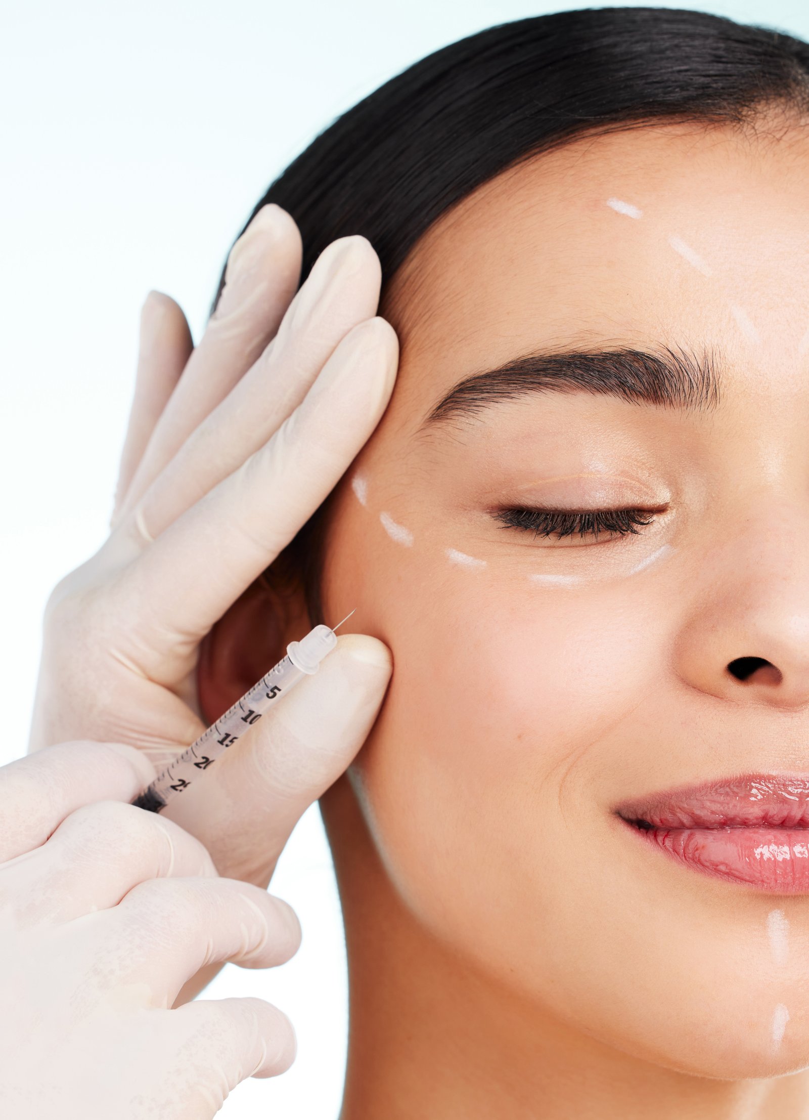 Botox / Toxina Botulínica